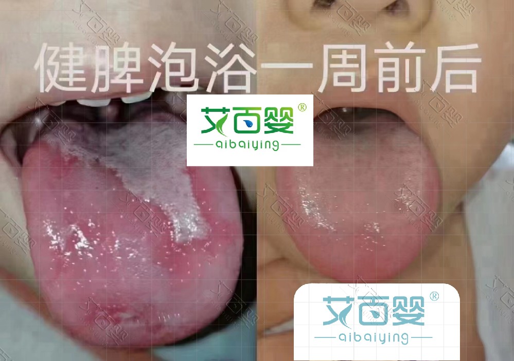 產(chǎn)品好評(píng)35